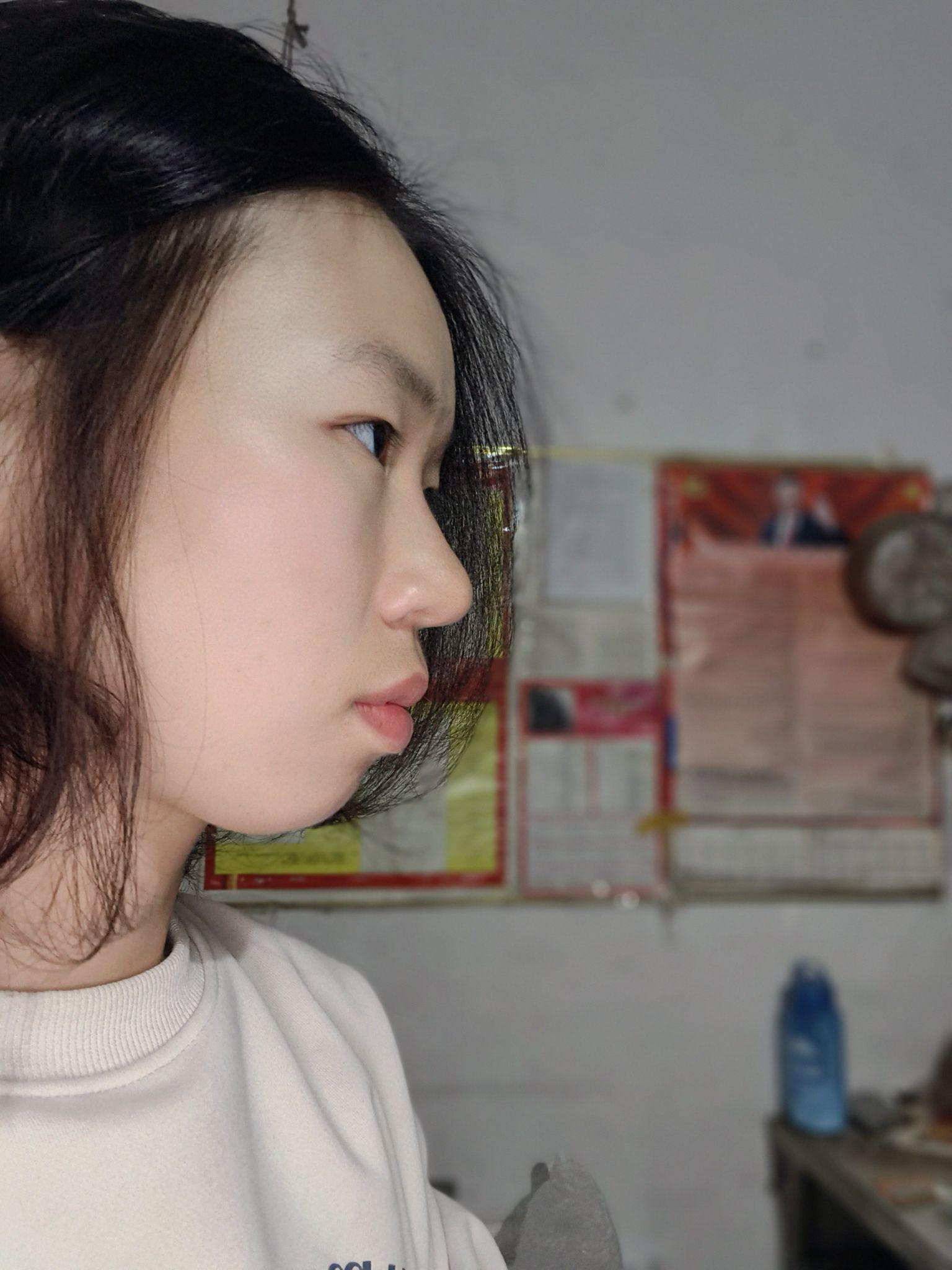 正脸好看但侧脸丑到爆是种怎样的体验?