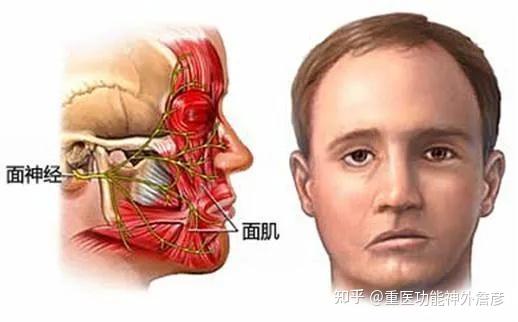 莫名挤眉弄眼扮鬼脸原来是面肌痉挛在作怪