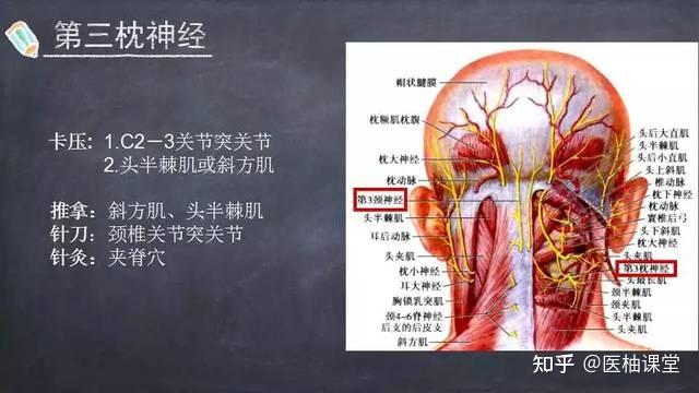 枕神經痛or偏頭痛有何區別如何治療