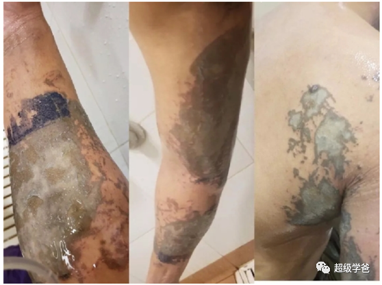 有人曾被腐蚀性液体灼伤,有人被咬断手指,有人遭暴徒利刃割喉,有人被