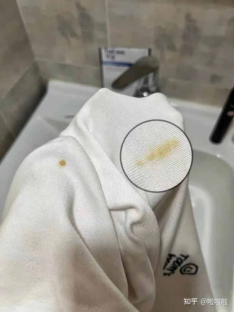 衣服变黄了咋整啊在线等急