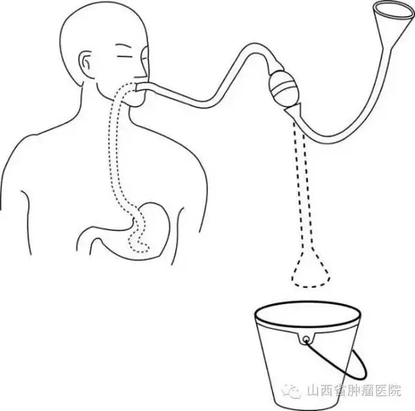 吃到毒物要洗胃,为什么不叫洗小肠呢?