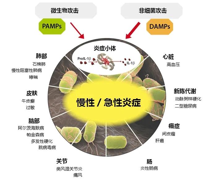 炎症专区(二):炎症从何而来?又该从何而去? - 知乎