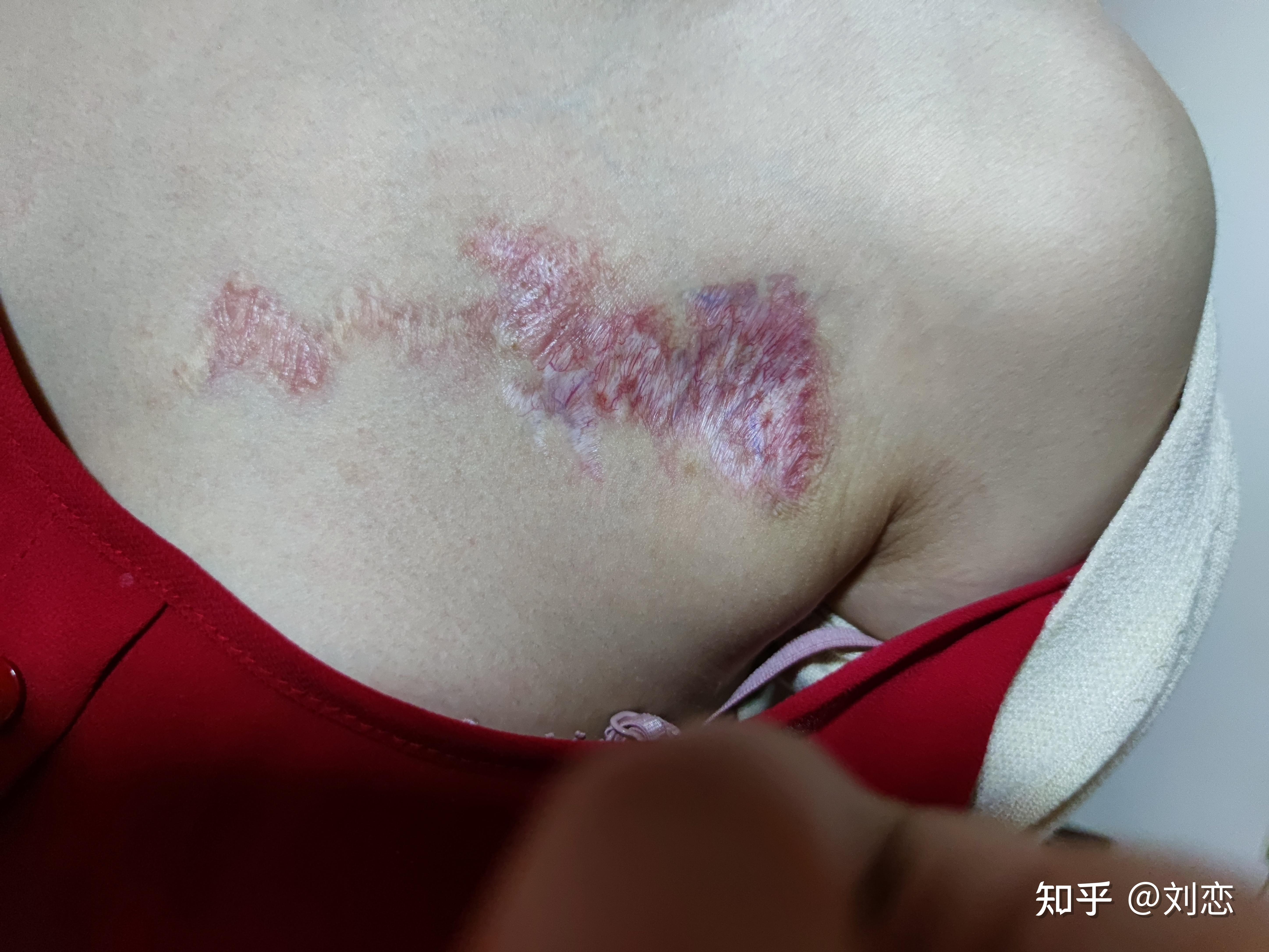 分享切纹身经历