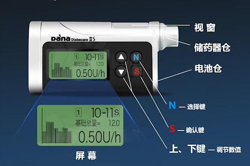 详解优泵胰岛素泵和丹纳2s胰岛素泵有什么区别
