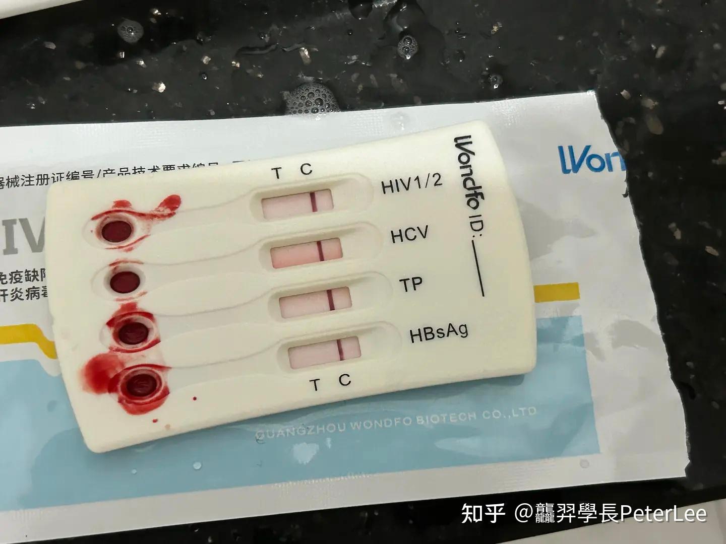 请问万孚四合一试纸测HIV准吗? - 知乎