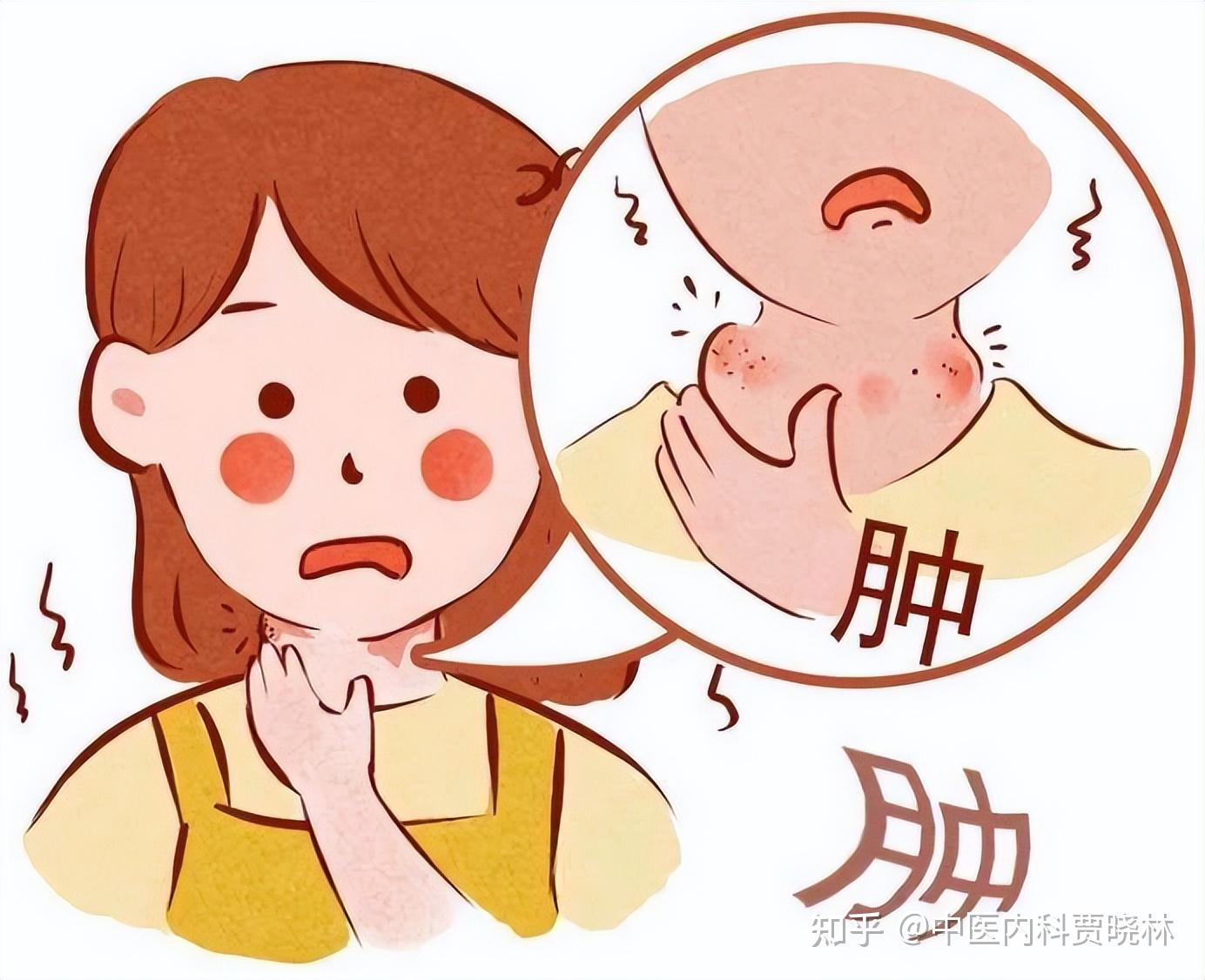 寒湿让人胖,痰湿让人病,湿热让人丑,医生教你一招,除尽湿毒 - 知乎