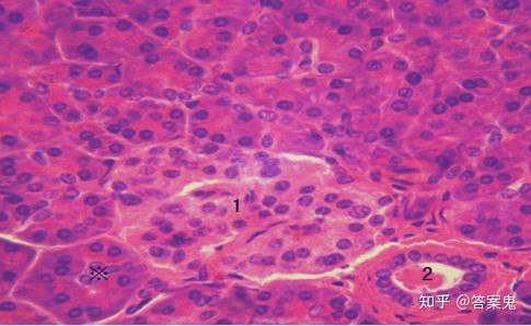 周围染色深的是浆液性腺泡,大小不等,单层腺细胞围成,腺腔不明显,有些