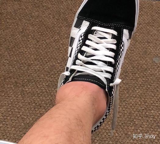 打篮球被人垫脚会有后遗症吗