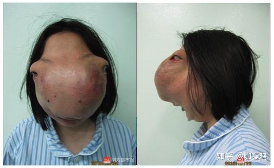 整容的极限是什么?