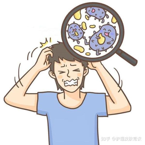 【肤康·科普】头皮上总能抠到硬痂,是什么? - 知乎