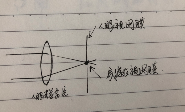 第二十二讲近视形成原因及矫正原理