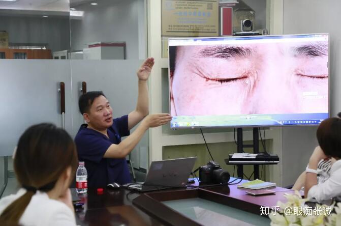 眼痴张诚说系列二内眦赘皮整形的五字江湖之毁字