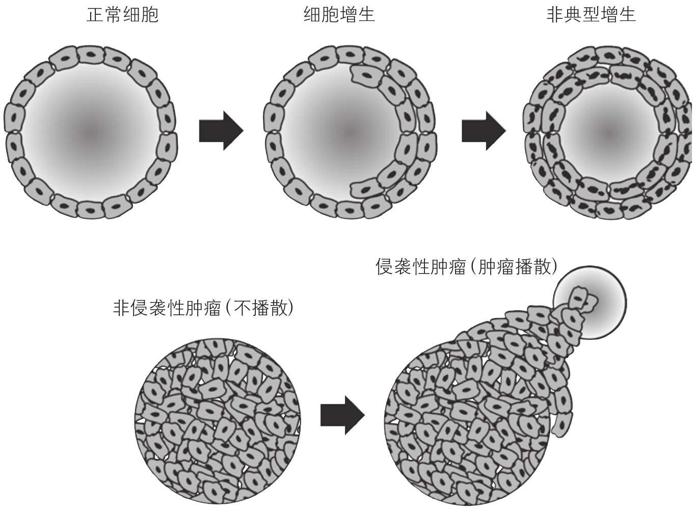 如何从细胞层面读懂恶性肿瘤? - 知乎