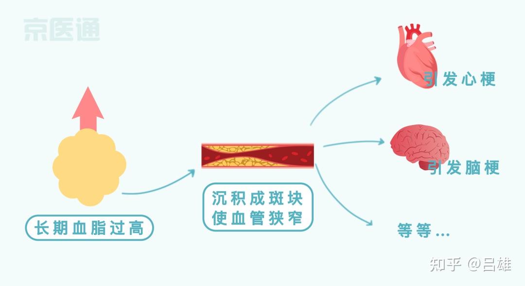高血压、高血糖、高血脂,三者是什么关系? - 知乎