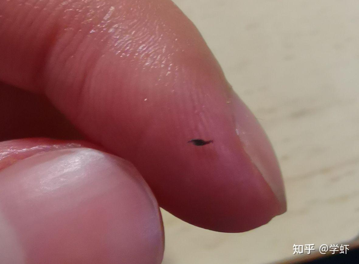 你有试过用夹子把黑头夹出来吗? - 知乎