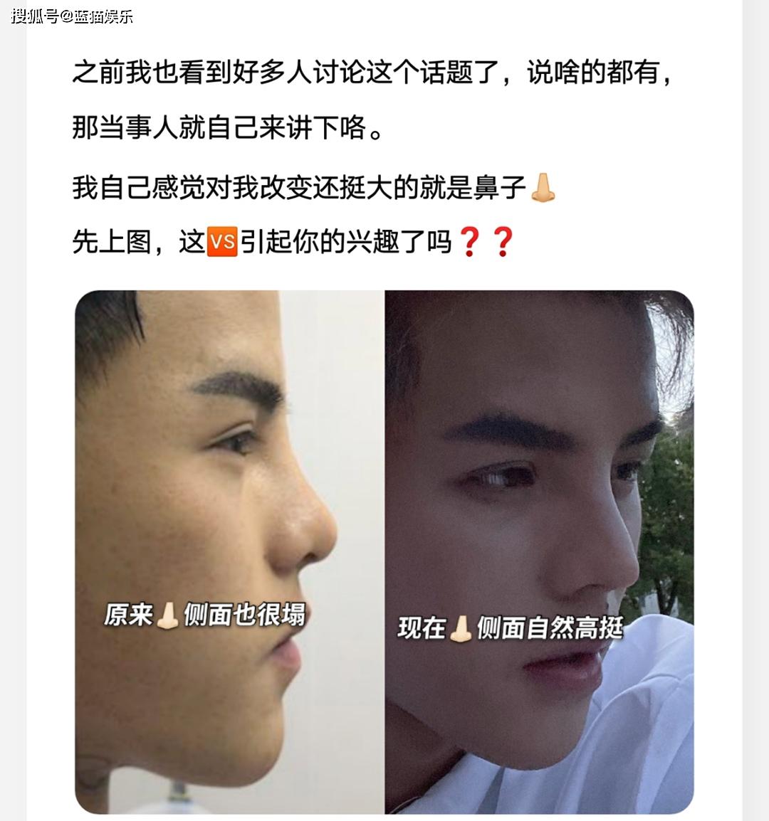 失落的殷世航靠晒整容过程博眼球