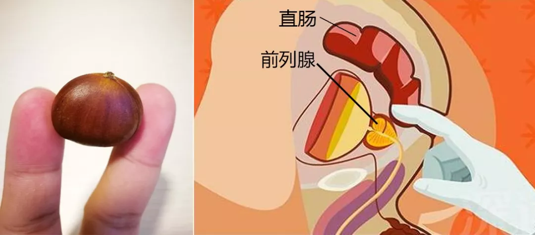 美女你的前列腺炎好了嗎