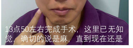 牙医碰见最烂的牙有多烂?