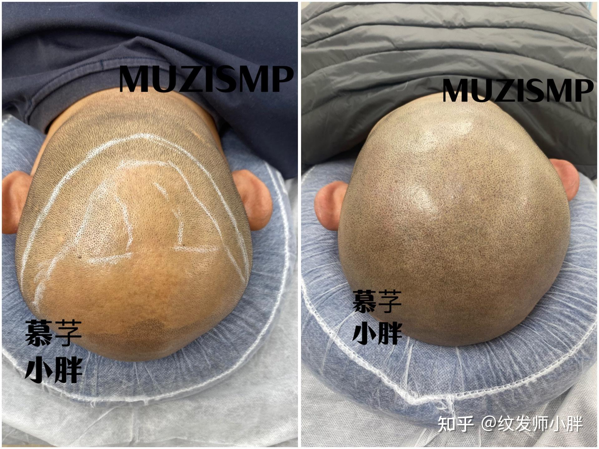 男生光头是种什么体验? - 知乎