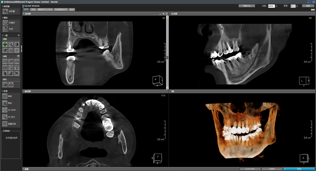 伯爵cbct影像篇⑦产品特点