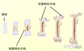 快速精准阅读X线片，读完这篇你也可以！ - 知乎