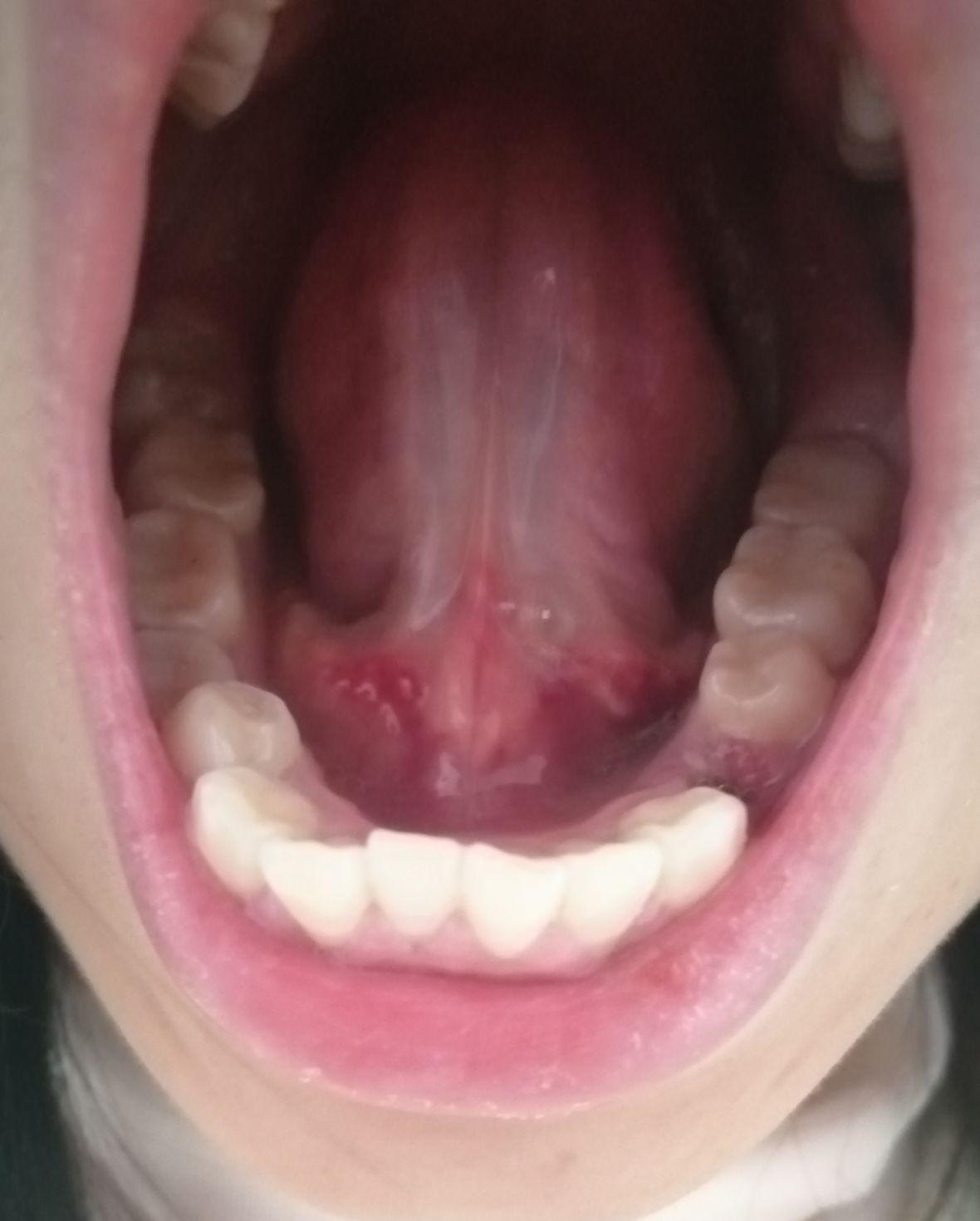 骨性牙突的改变地点常州北极星口腔钟楼区分院