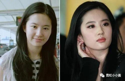 远观美人是啥 如何在100米之外美倒路人 日本医美 知乎 远观美人是啥 如何在100米之外美倒路人 日本医美 知乎