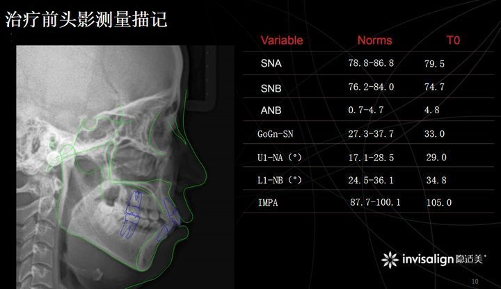 广角畸变修正图片