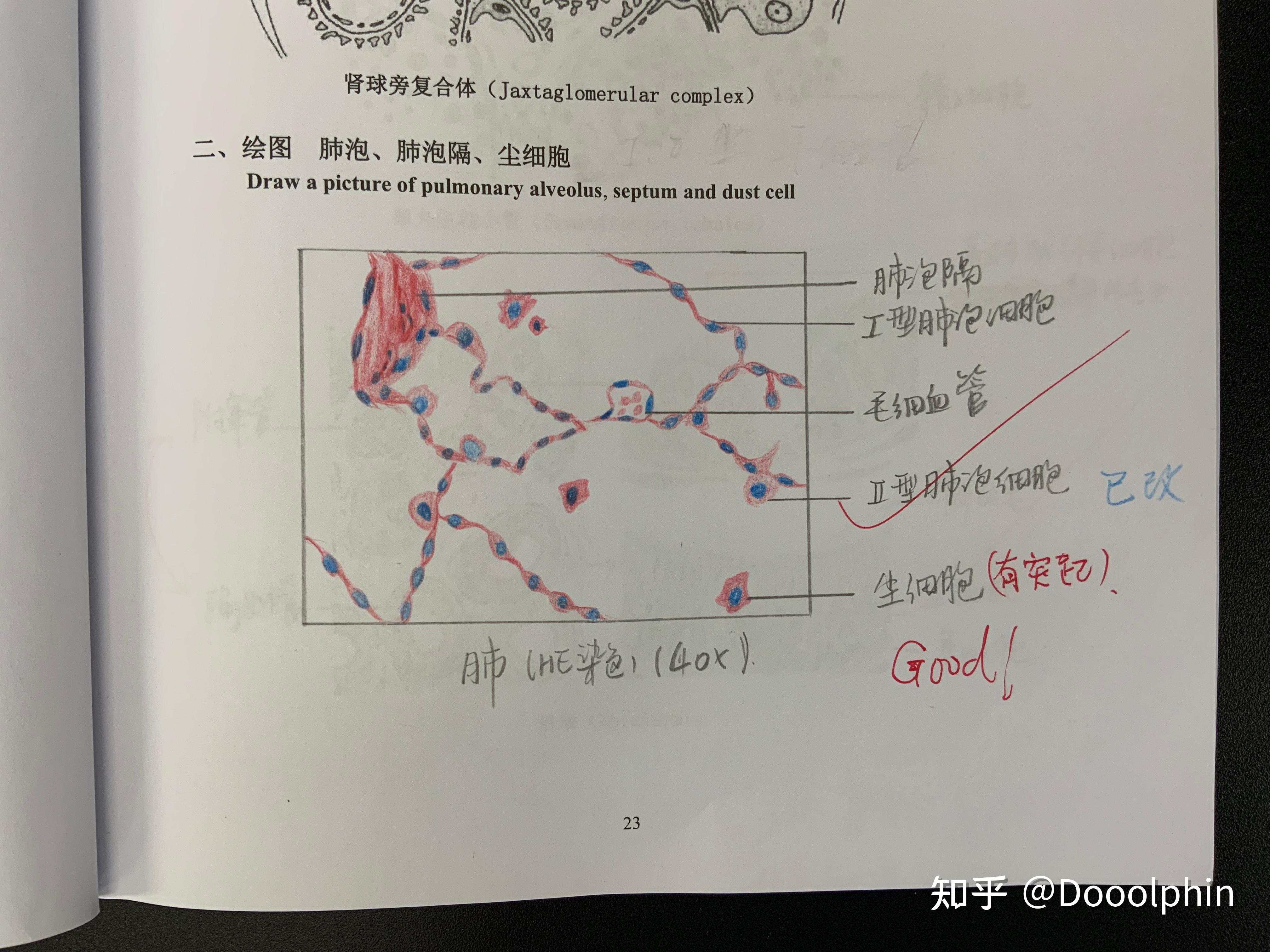 肺泡壁手绘图图片