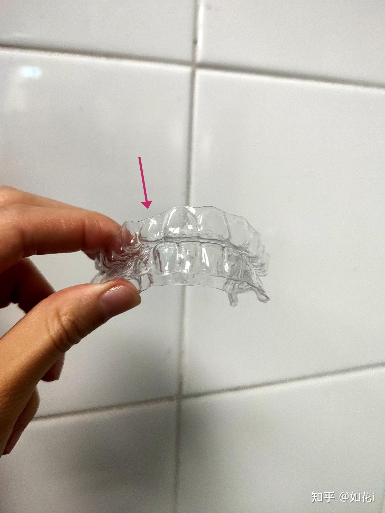 我的保持器又断了一副保持器寿命是多长呢