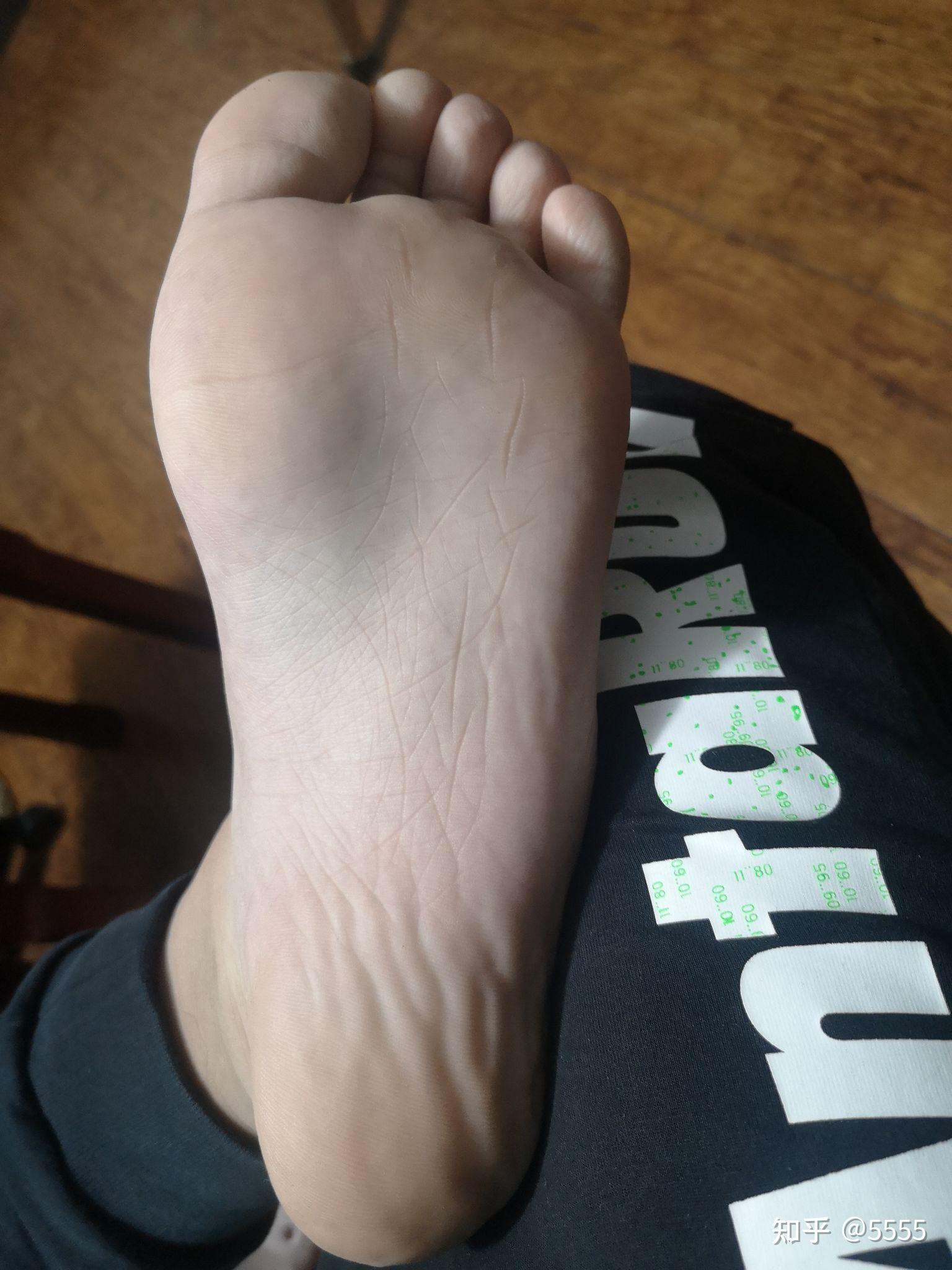 男孩脚底照片有什么问题吗?