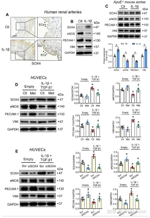 SOX4是单细胞分析揭示的动脉粥样硬化内皮细胞的新型表型调节因子 - 知乎