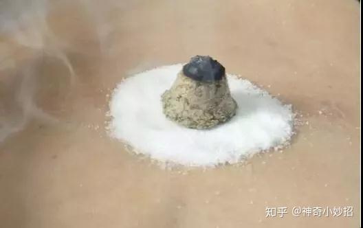 什么是隔物灸?