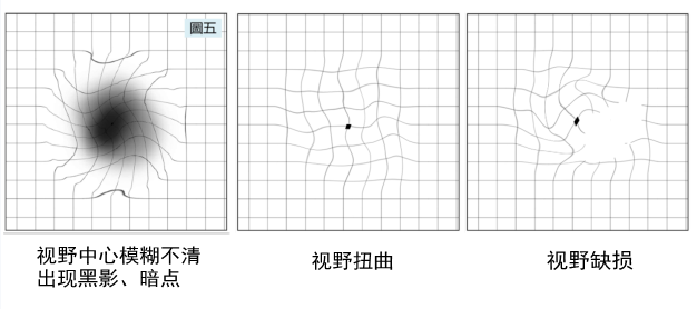 视物变形自测图片