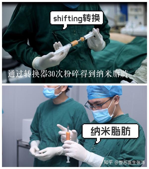 脂肪移植黑科技——SVF-gel脂肪干细胞胶 - 知乎