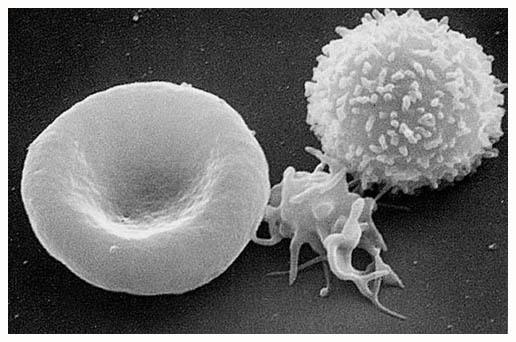 血小板为什么会增多 知乎