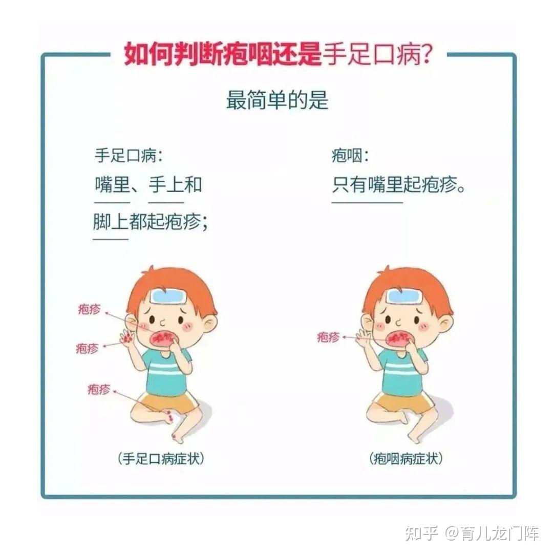 疱疹性咽峡炎与手足口病一样吗?