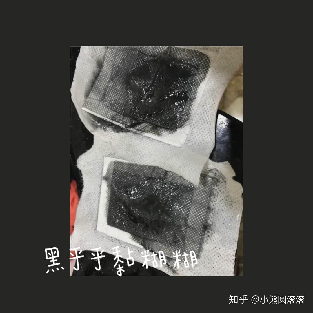 拔罐为什么可以祛湿气 v2-f8d037ea152686937998595555306e68_r.jpg