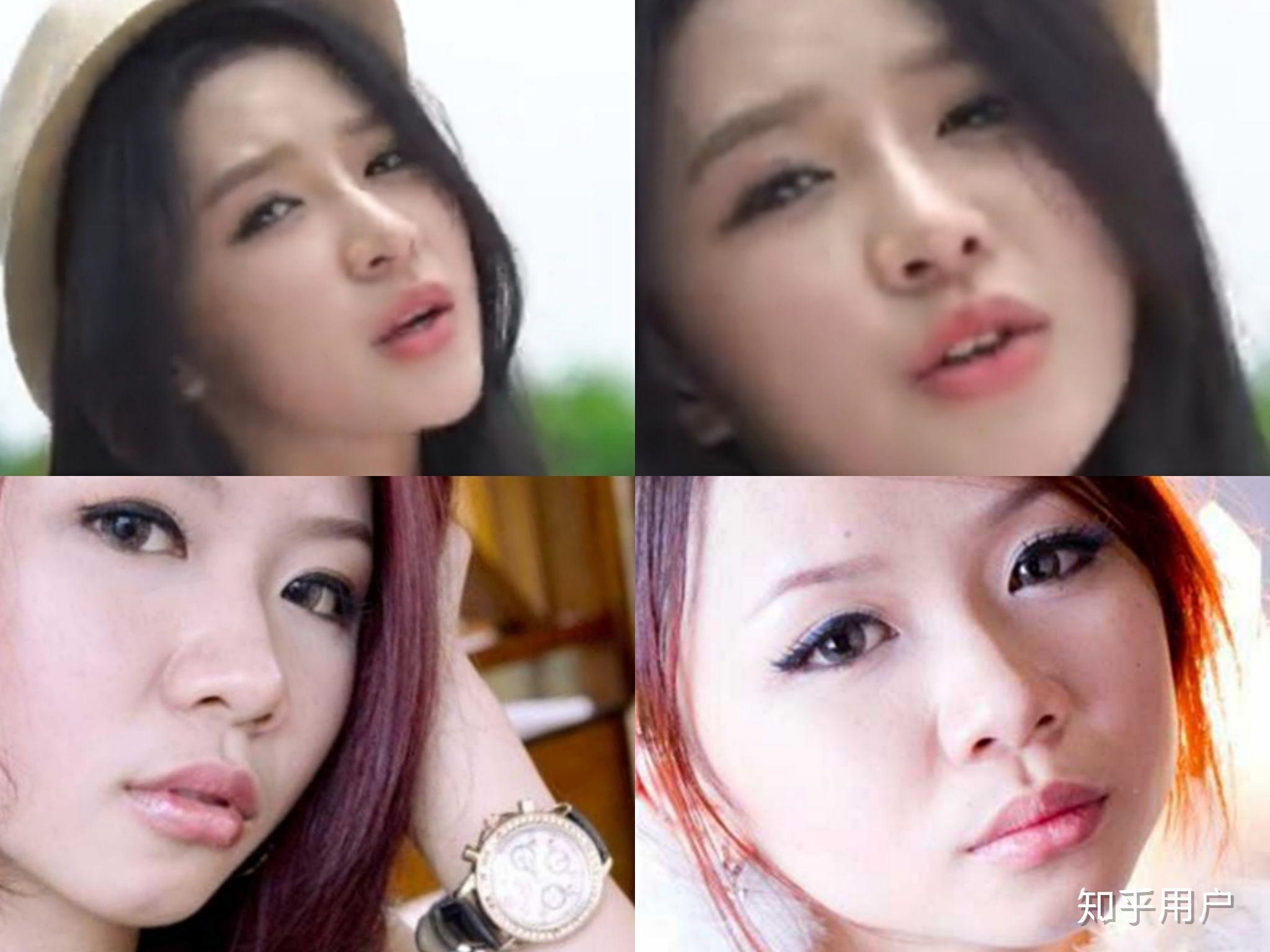 蔡卓宜是整容脸吗?