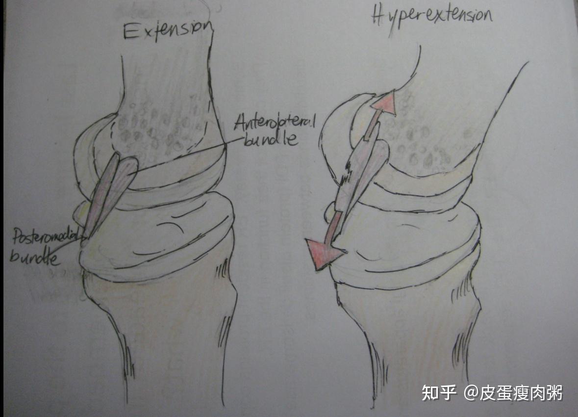 史上最残忍的拉韧带图片