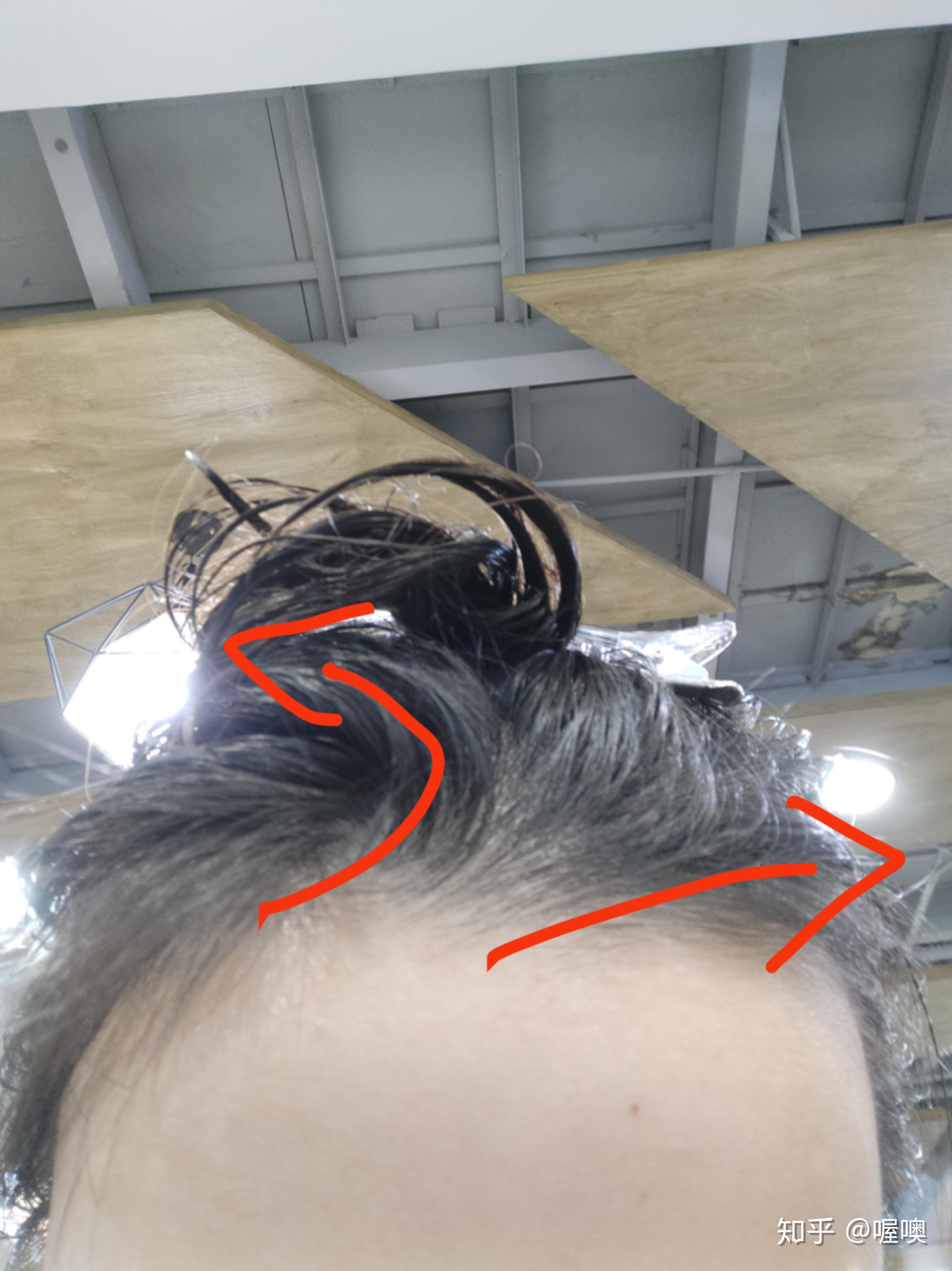 女生发际线处有个旋很难做发型有同胞么怎么破