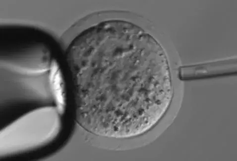 辅助生殖技术--ICSI