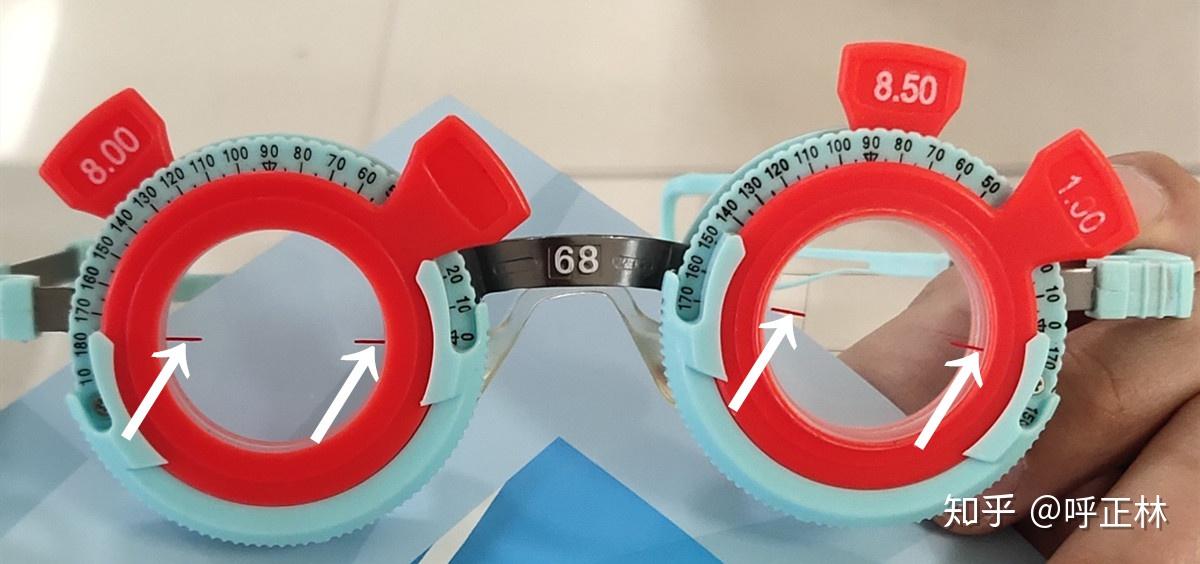 请问这个配镜散光是多少轴向