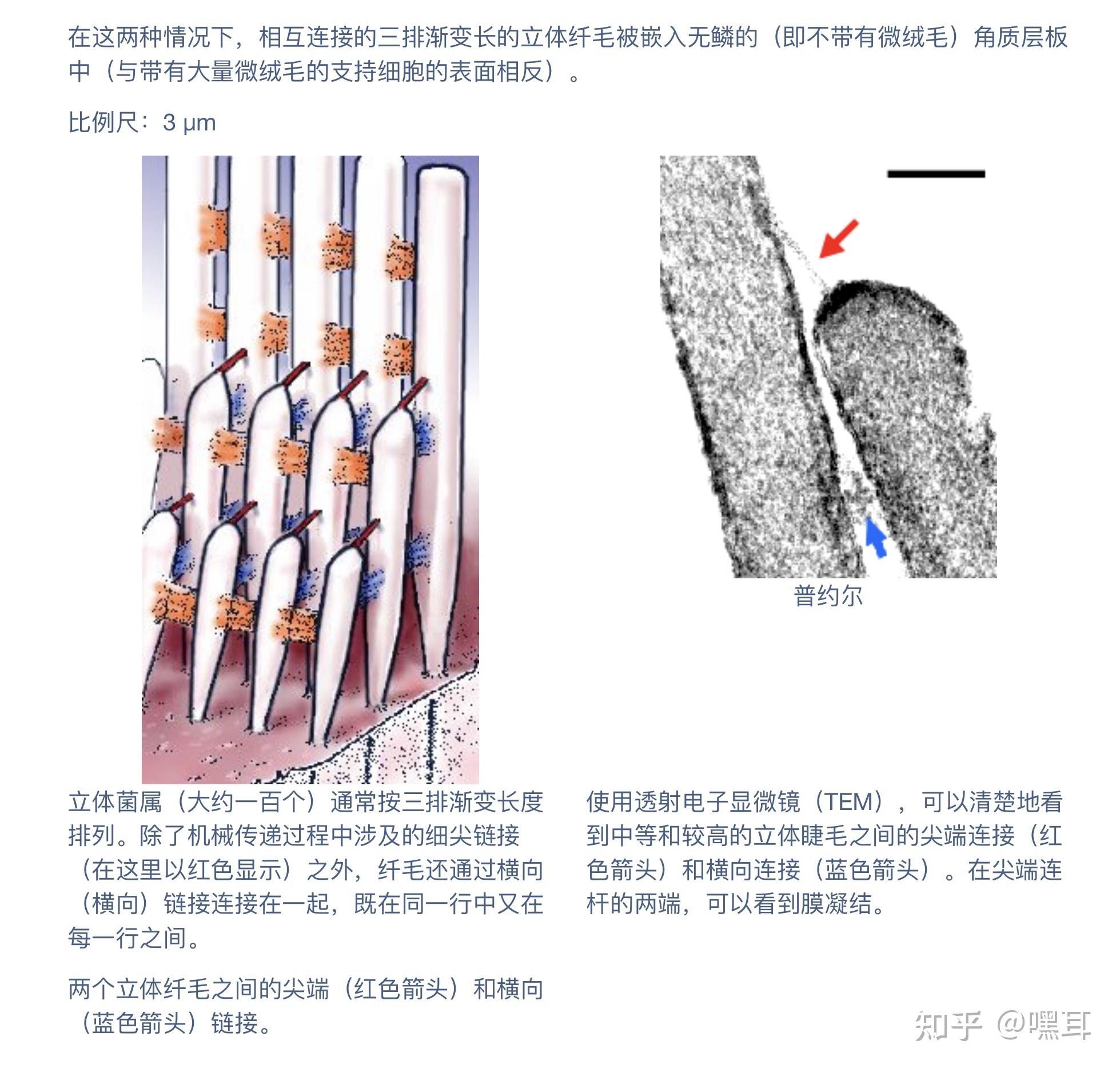 耳蜗毛细胞为什么分内毛细胞和外毛细胞哪个更重要