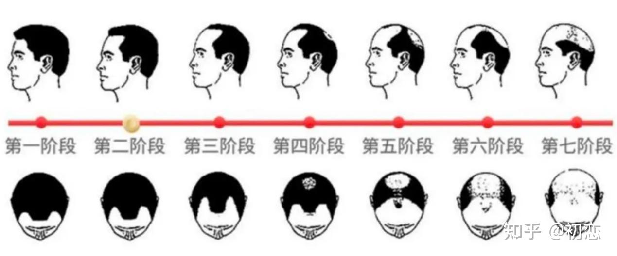 让头发长在头顶是年轻人最后的倔强,蔓迪米诺地尔酊真能早生秀发 - 知乎