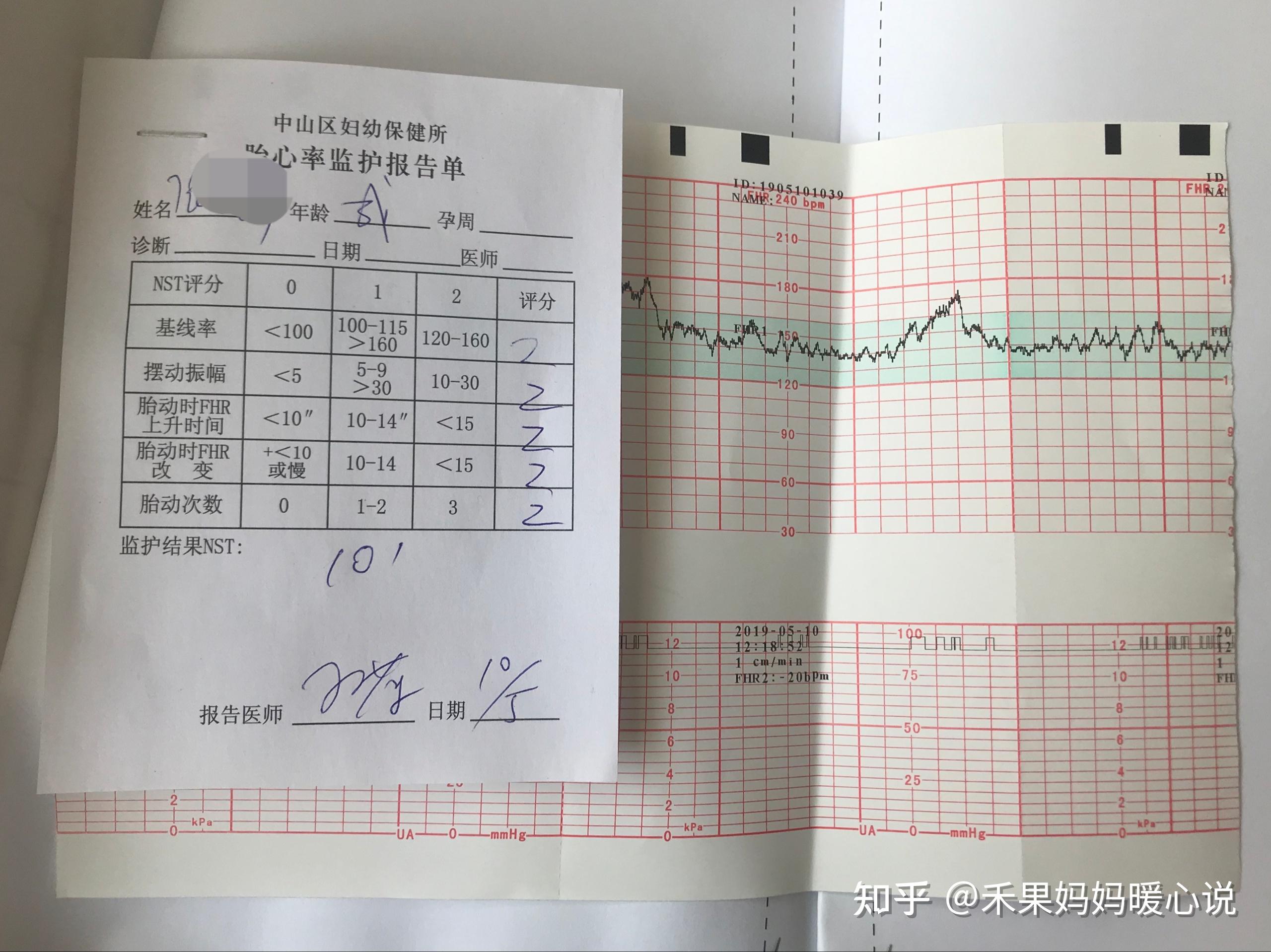 懷孕期間的孕檢主要是檢查什麼都有哪些項目