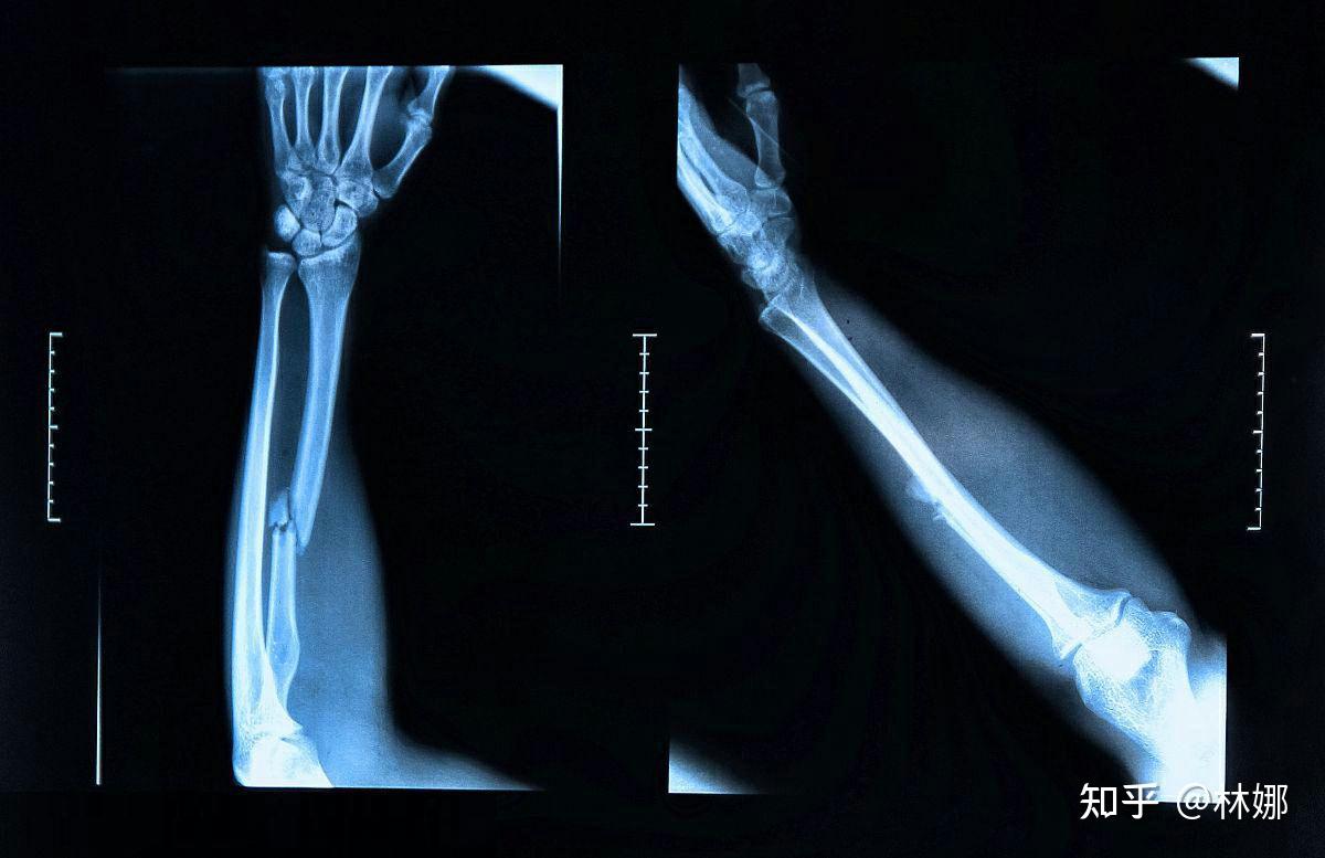 先天性手部畸形与后天性手部畸形治疗_郑州仁济医院