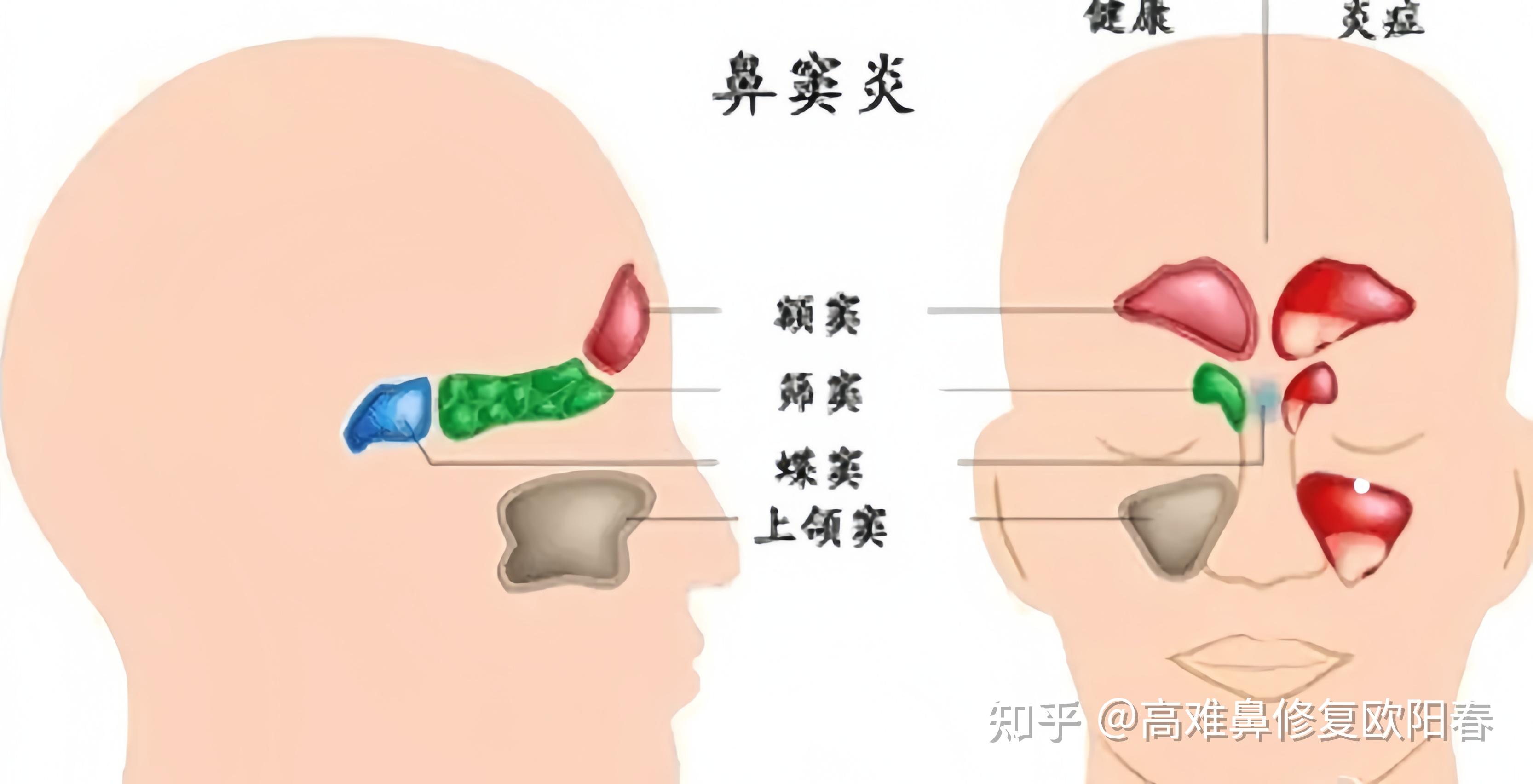 鼻子的图片 示意图图片