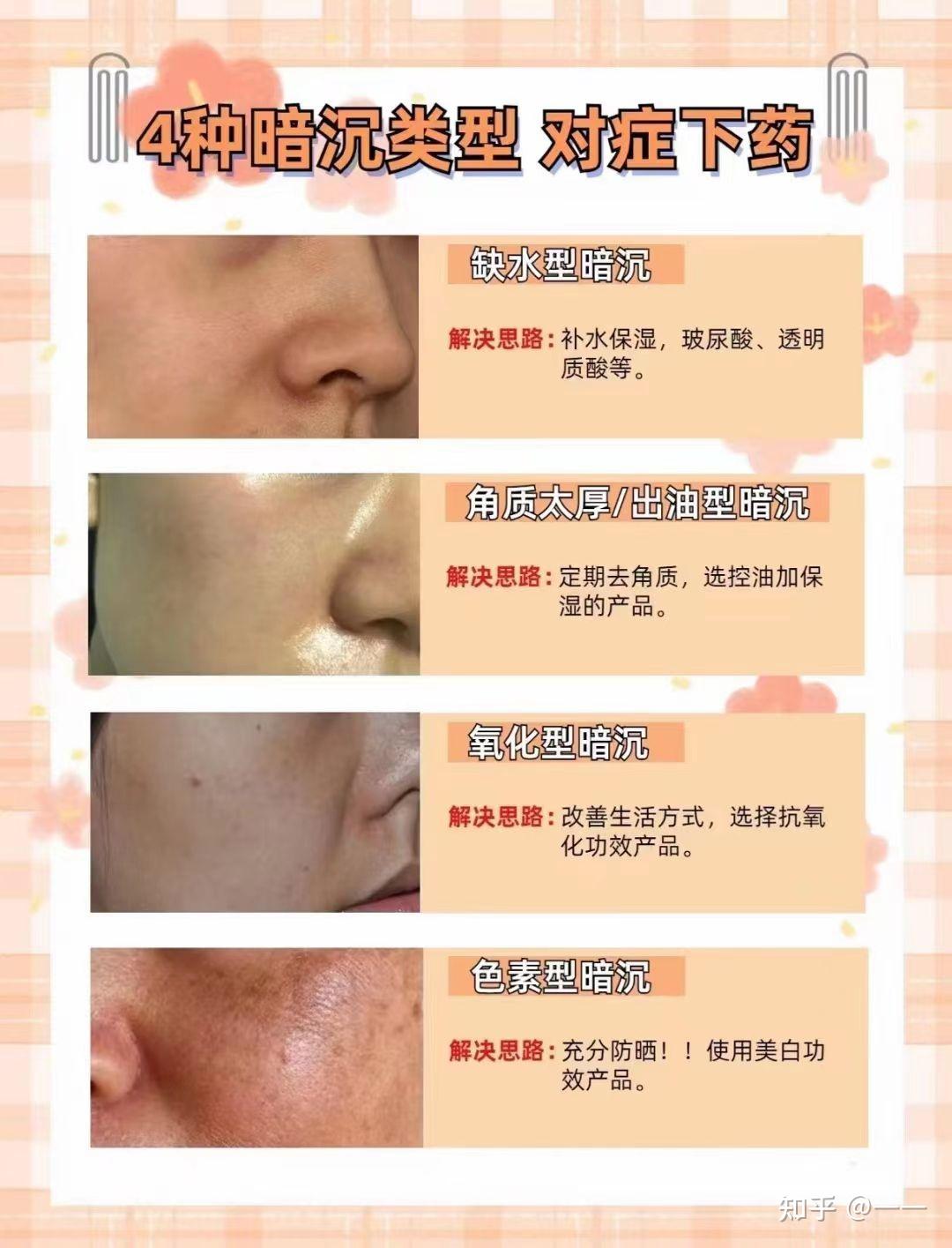 油、敏、红、痒、刺痛，长痘，闭口，毛周角化，毛孔粗大，皮肤暗沉，油性敏感肌怎么恢复？ - 知乎